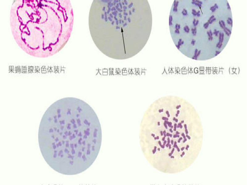 染色體玻片